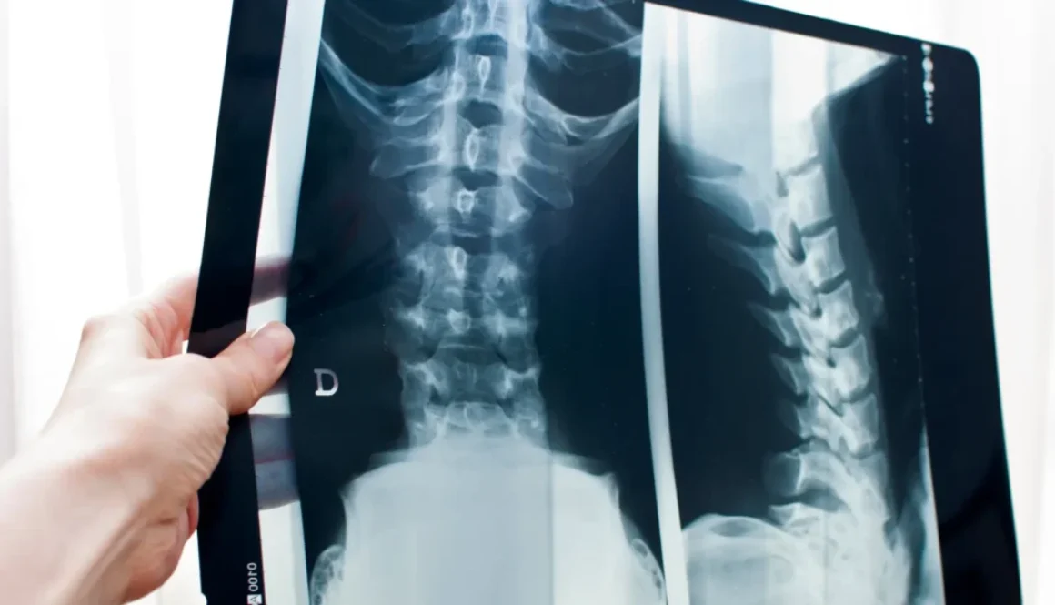 x-ray-blog